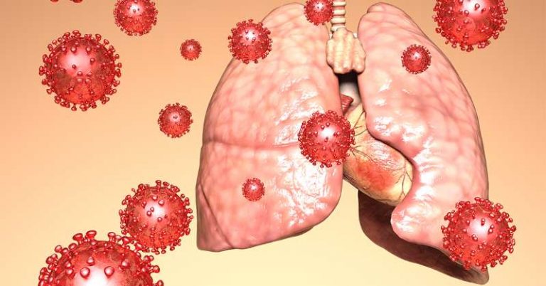 新冠肺炎（一）